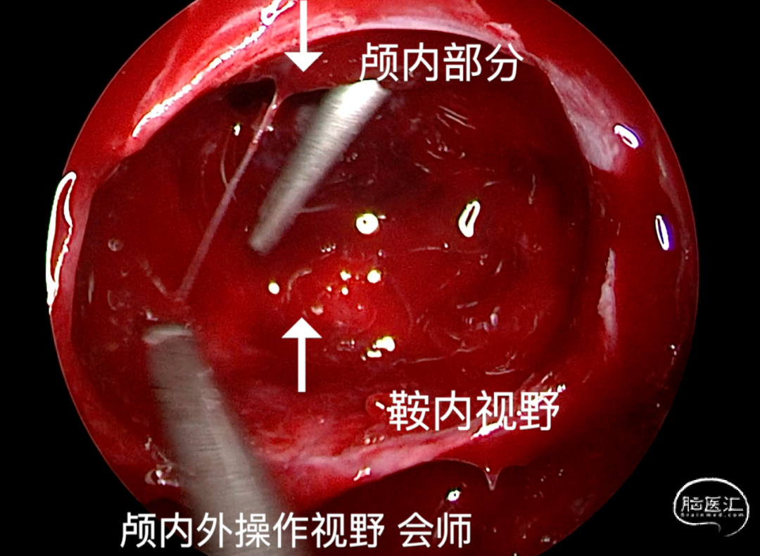 6eab48e1077654f4c2bf1893541e147f_640_wx_fmt=png&wxfrom=5&wx_lazy=1&wx_co=1.png