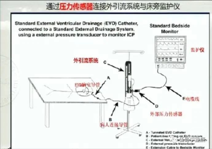 重症学习第二周笔记 - 脑医汇