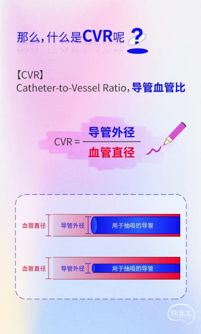 【卒中美谈丨漫说文献】CVR影响抽吸成功率，那你知道CVR是什么吗？ - 脑医汇