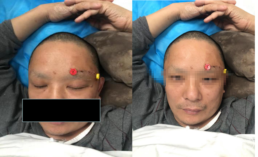 精准医学背景下个体化治疗联合微创快速康复理念这个科