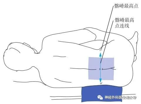 腰椎穿刺术的解剖路径