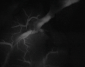 mqh1.gif