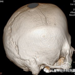 性,特别指出的是即使已经30岁,依然可以看到清晰的额缝,即使其已闭合