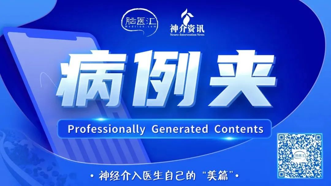 【病例夹】曹毅主任团队：Y型支架辅助弹簧圈栓塞治疗大脑中动脉分叉部动脉瘤1例