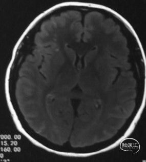 11c117d0-d10d-11ec-883a-e71417e63b10.jpg