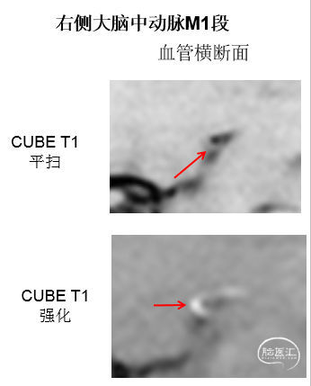 ab008c90-d10e-11ec-883a-e71417e63b10.jpg