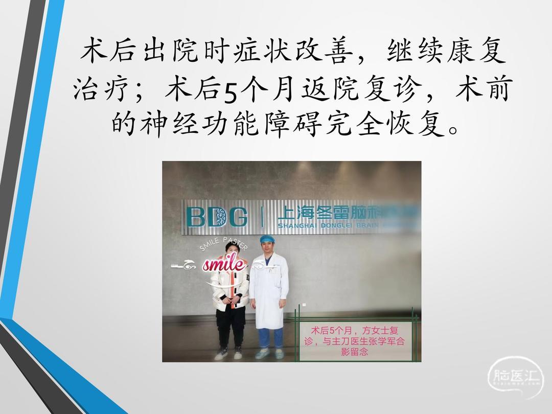 延髓海绵状血管瘤_12.jpg