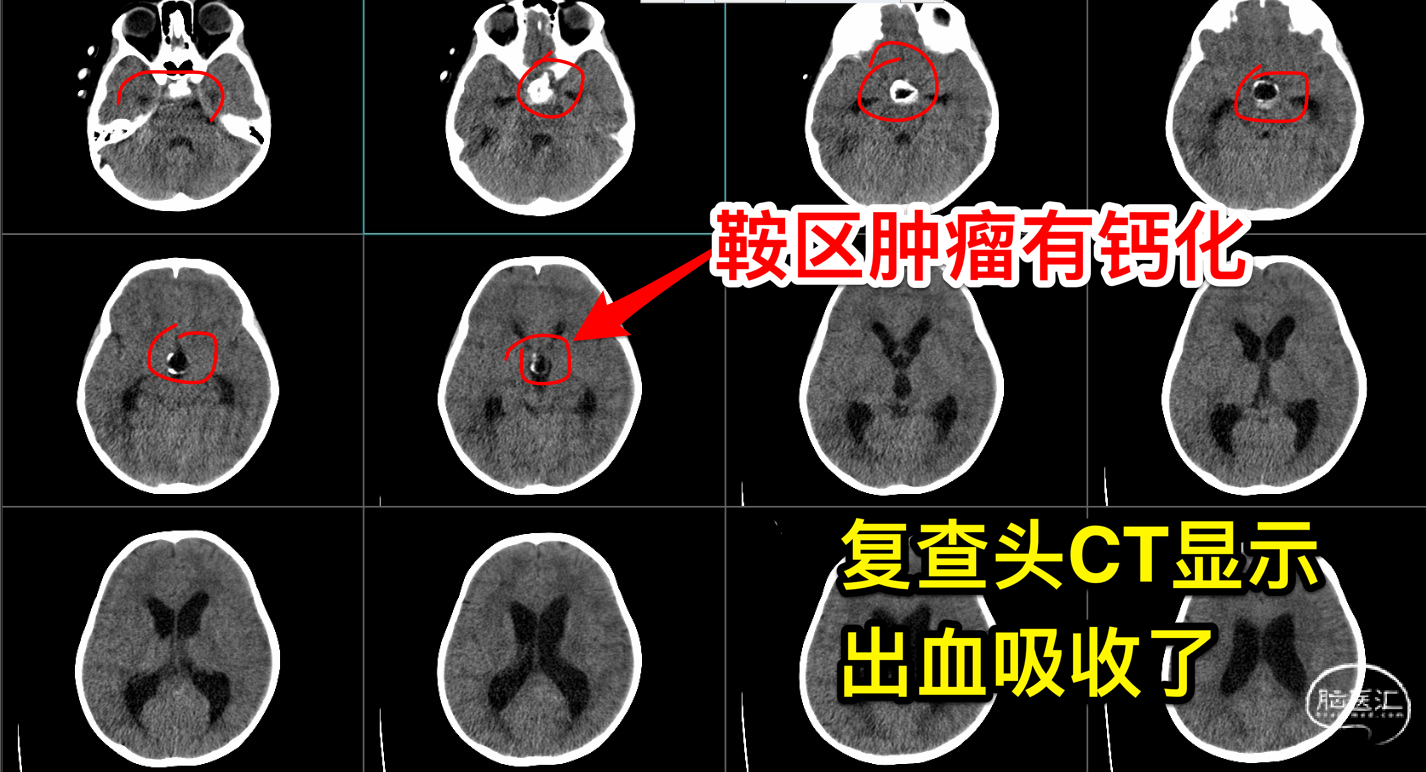 20220520164542_sus2lv1t6k.png