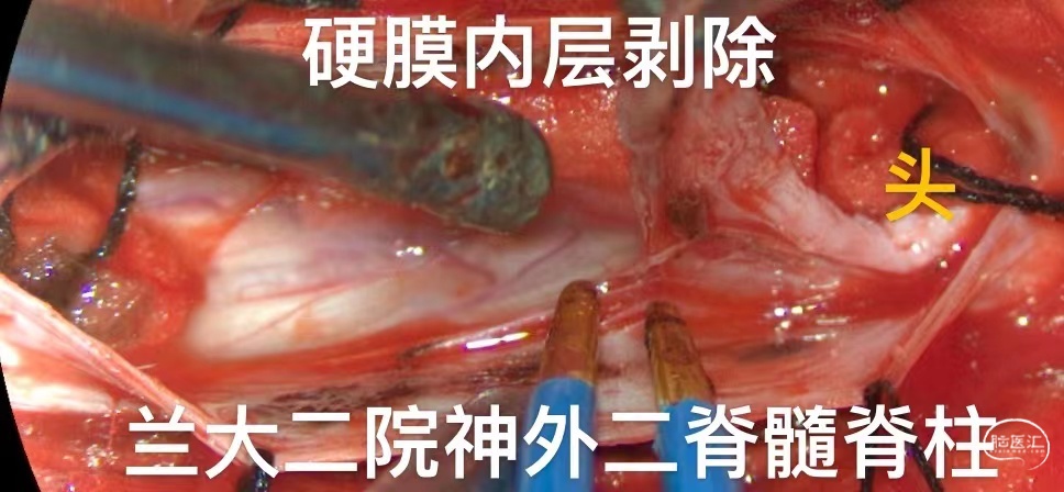 78e466f9de954a1b424cc078d822f30d_.jpg