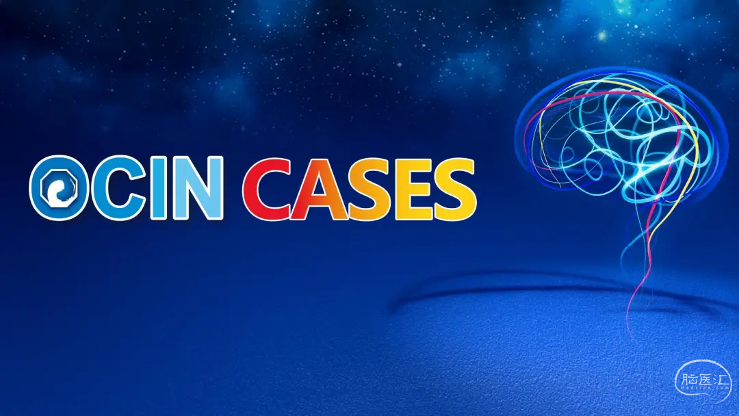 【OCIN CASES】教学病例-21：前交通假性动脉瘤