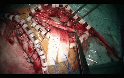 8.gif