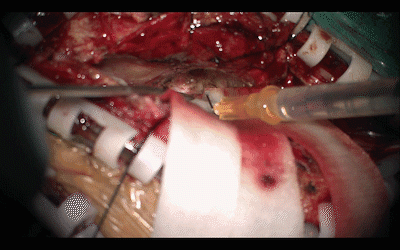4_1.gif