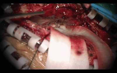 5.gif