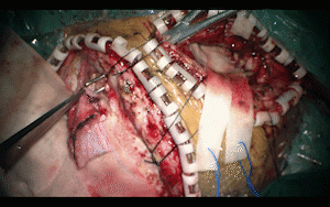 7.gif