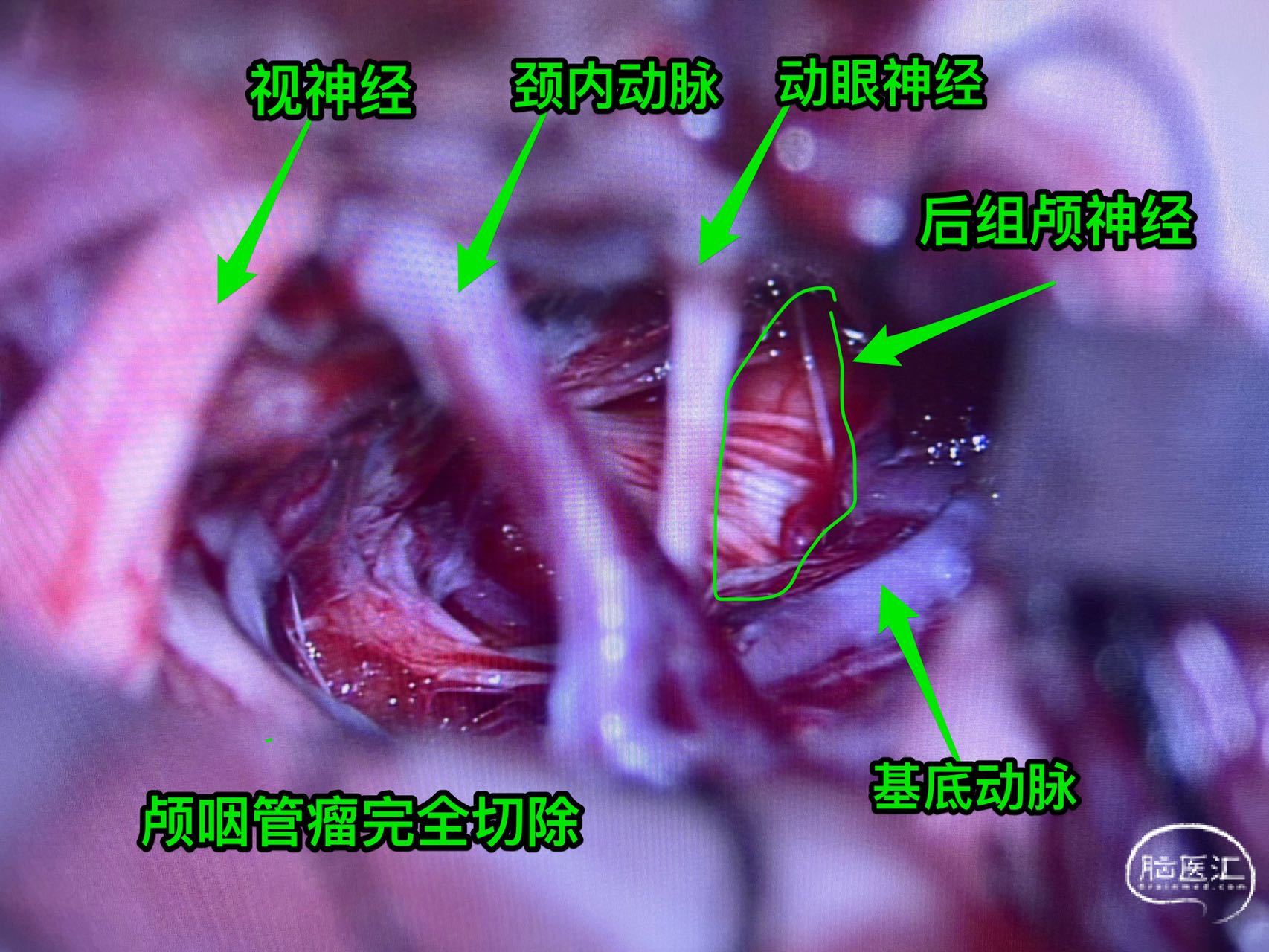 772f1035d85fd674519e7d05fc976d0c.jpg