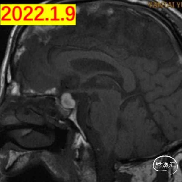 微信截图_20221020101447.png