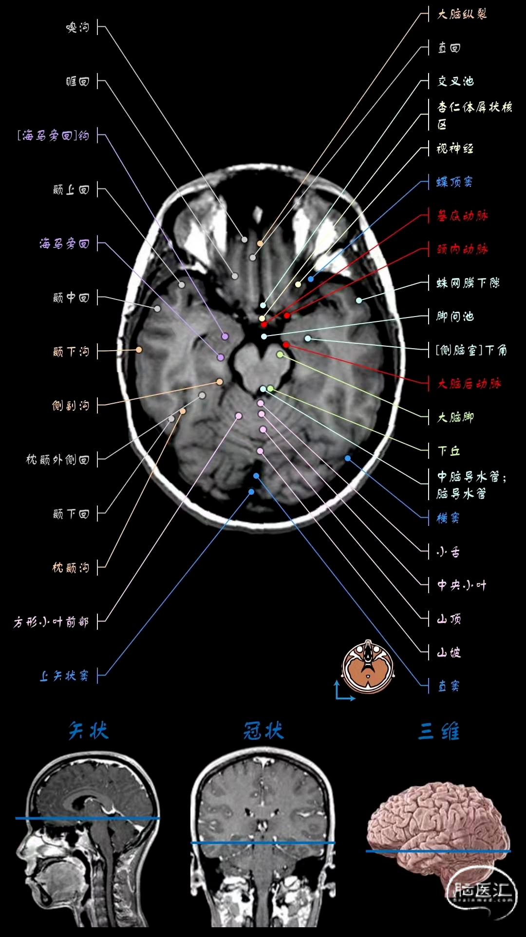 颅脑先天性疾病影像诊断_畸形