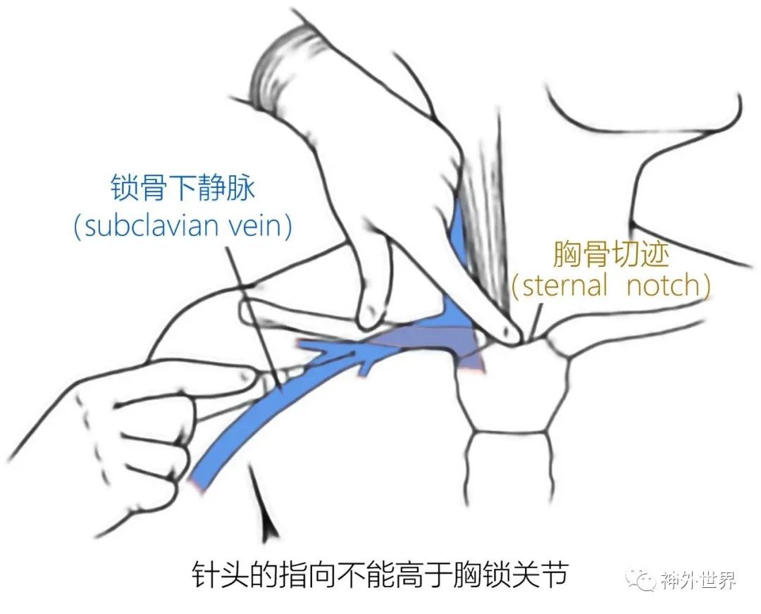 锁骨中线位置图片,正常人腹中线图片,腹股沟在哪个位置图片_大山谷图库
