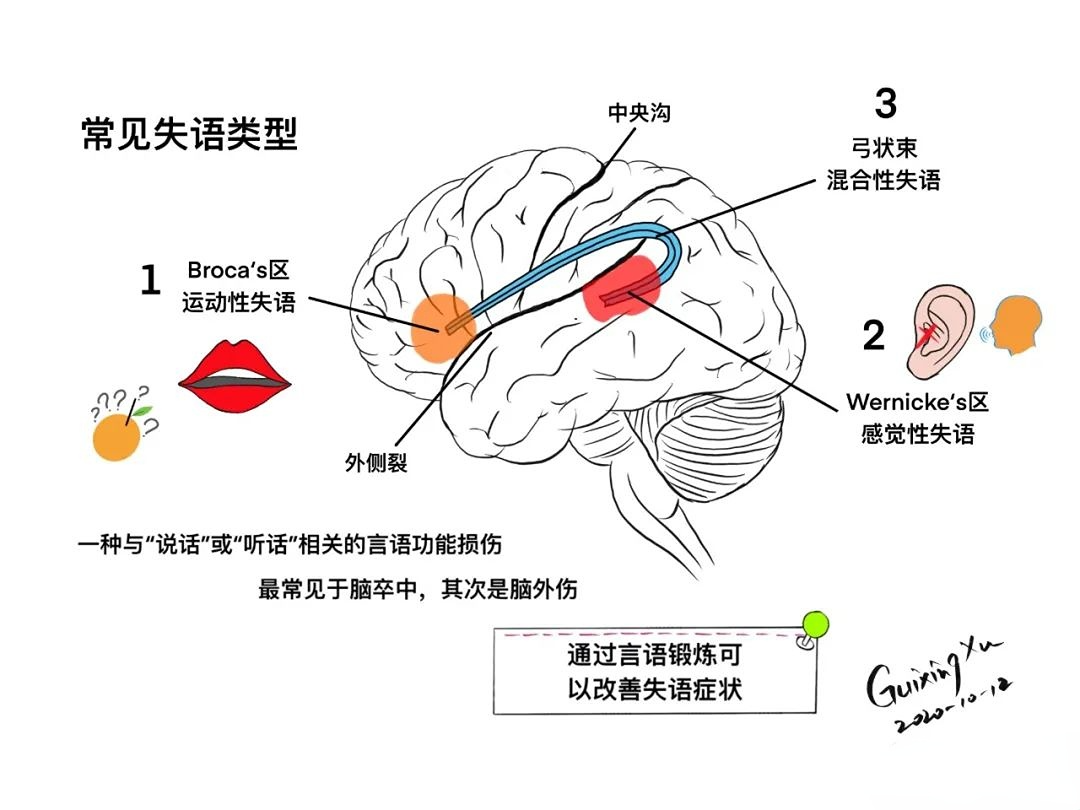 神经系统经典知识点图解 - 脑医汇