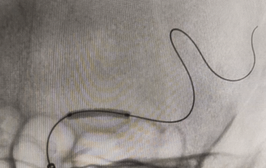 image36.GIF