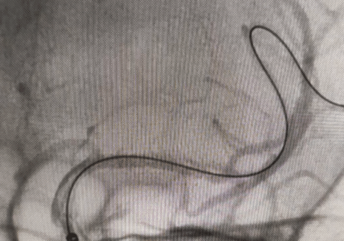 image37.GIF