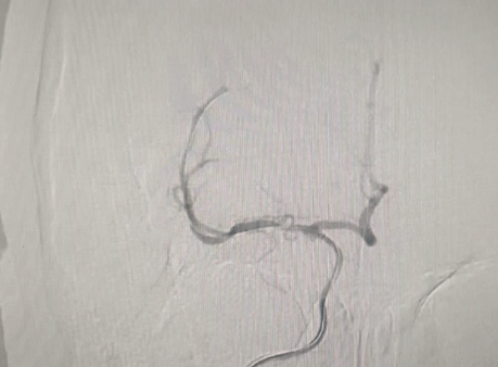 image19.GIF