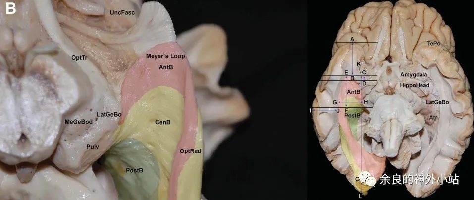解剖学㊤㊦ Visual Anatomy 視覚解剖学