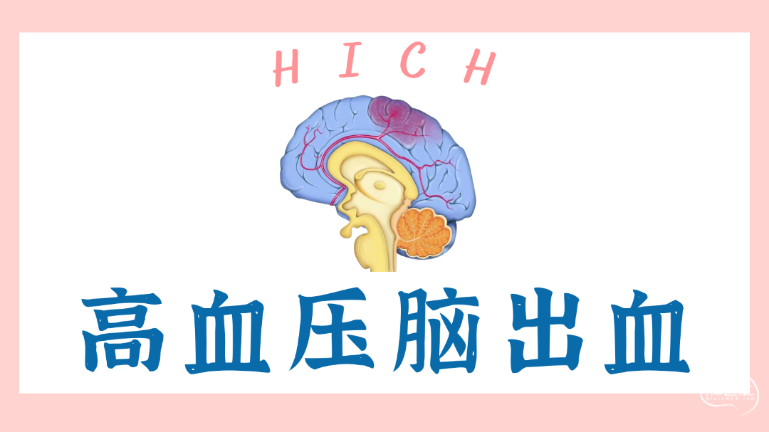 高血压脑出血的治疗.png