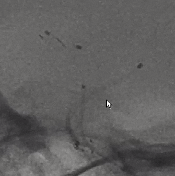 13.gif