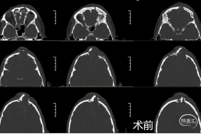 WPS图片(1)副本.png