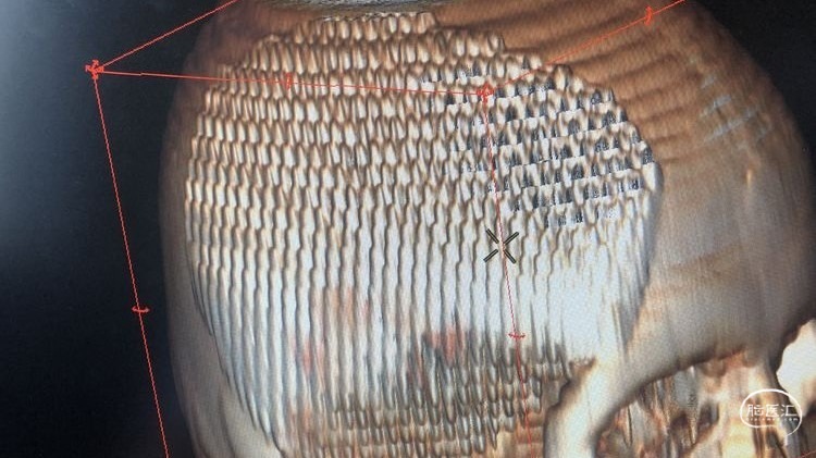 20210601105020_u6spoqd85c.jpg