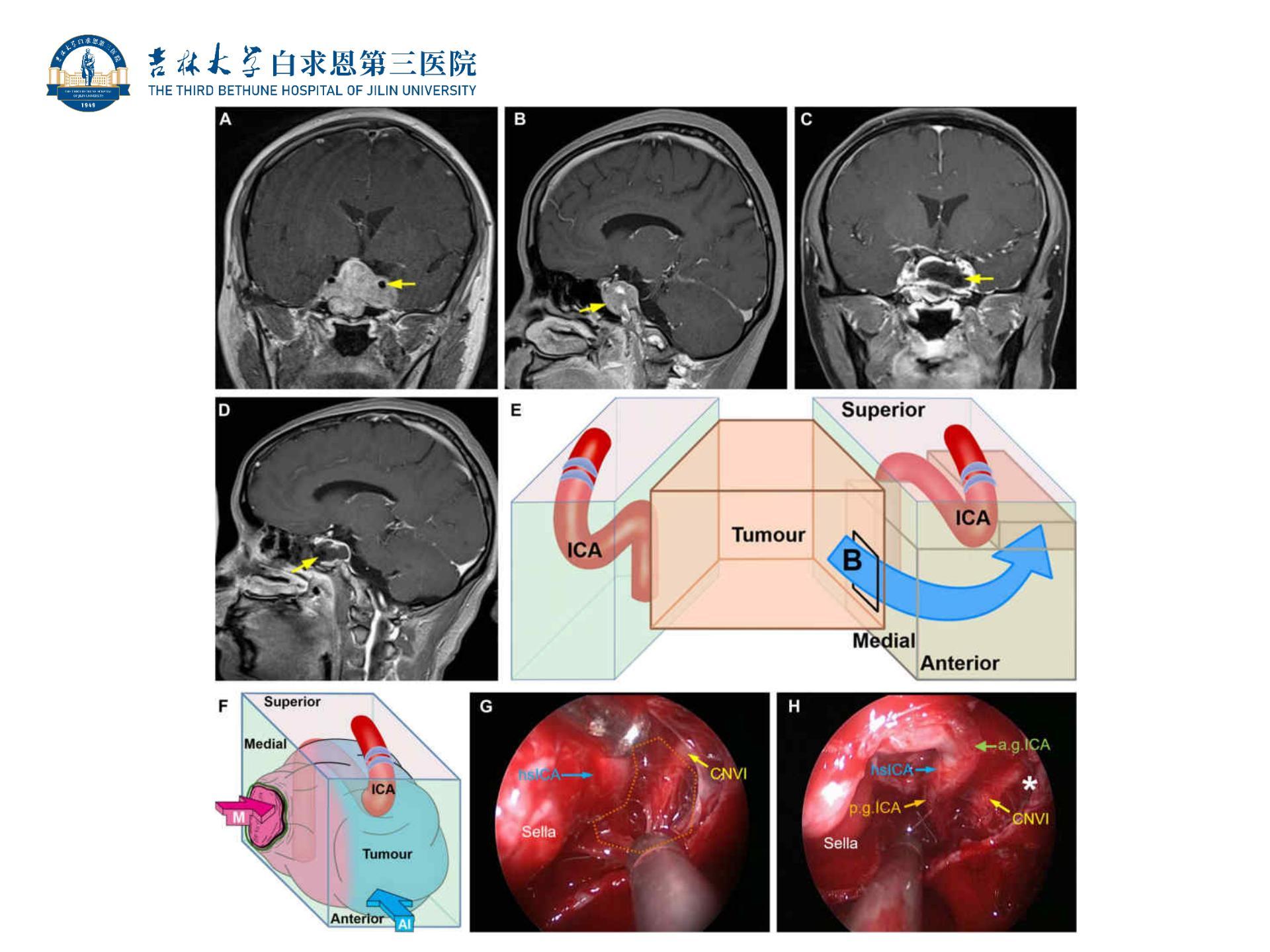 图1-11 颅底脑神经根和海绵窦-基础医学-医学