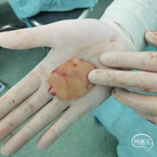 WPS图片(5).jpeg