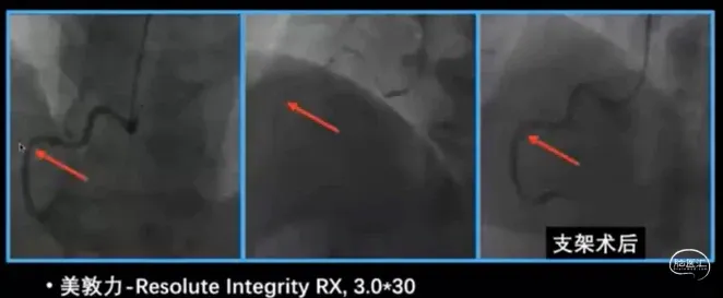 6.png