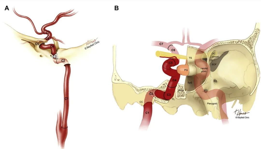 颈内动脉（internal carotid artery，ICA）分段