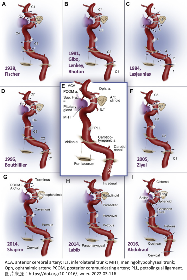 carotid artery图片