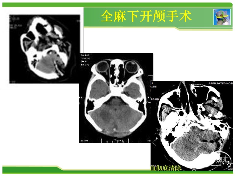 幻灯片16.jpg