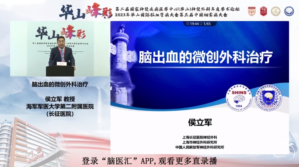 脑医汇_第二届华山峰彩国家神经疾病医学中心(华山)神经外科年度学术论坛丨华山国际脑血管病大会暨第三届中国烟雾病大会 - 突破鞍膈垂体腺瘤的手术策略 - 脑医汇 - 神外资讯 - 神介资讯_1688722656884.png