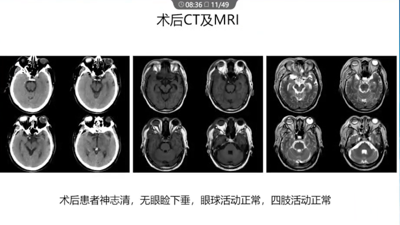序列 01060.png