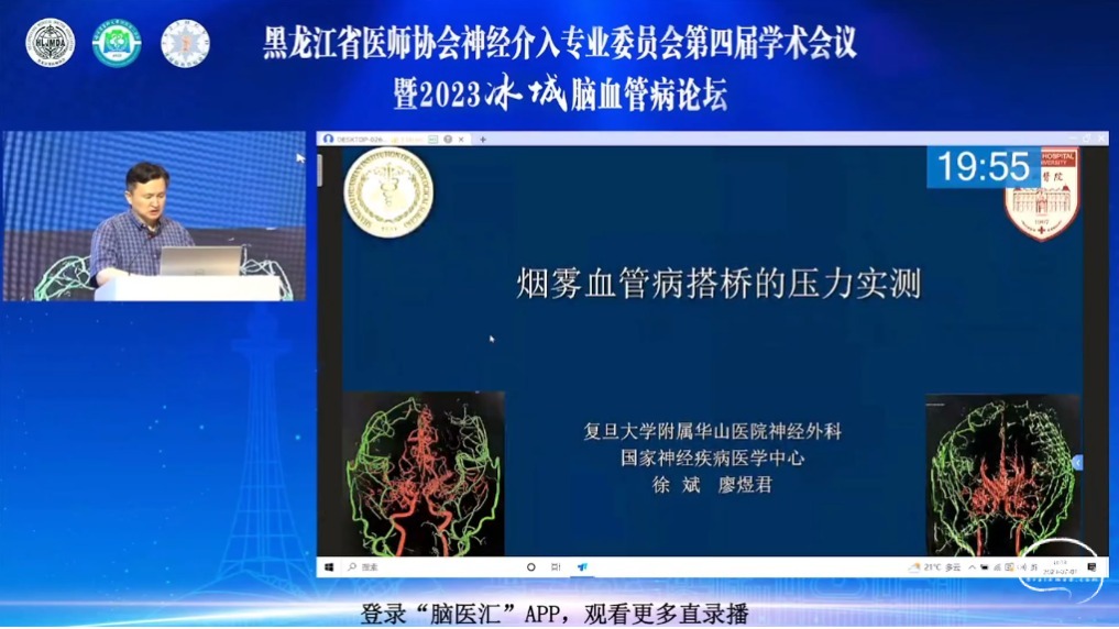 脑医汇_第二届华山峰彩国家神经疾病医学中心(华山)神经外科年度学术论坛丨华山国际脑血管病大会暨第三届中国烟雾病大会 - 突破鞍膈垂体腺瘤的手术策略 - 脑医汇 - 神外资讯 - 神介资讯_1688722656884.png