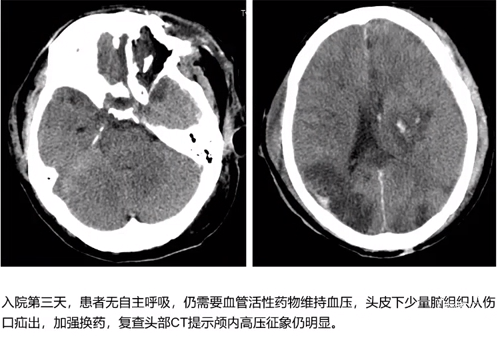 企业微信截图_16903425157632.png