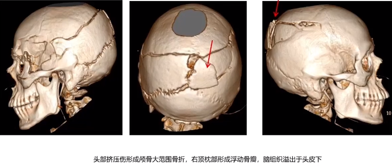 企业微信截图_16903424717698.png