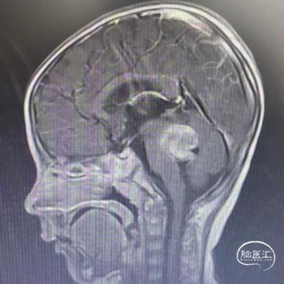 WPS图片(4).jpeg