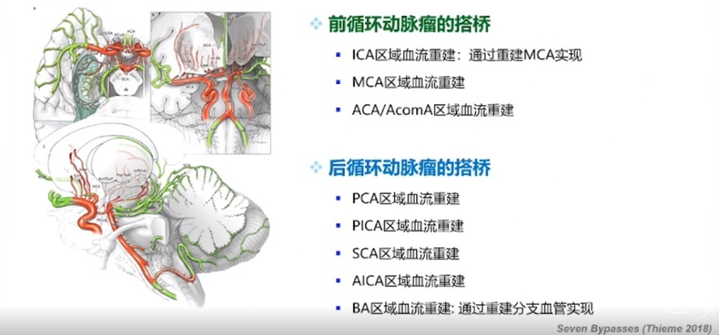 企业微信截图_16908745339490.png