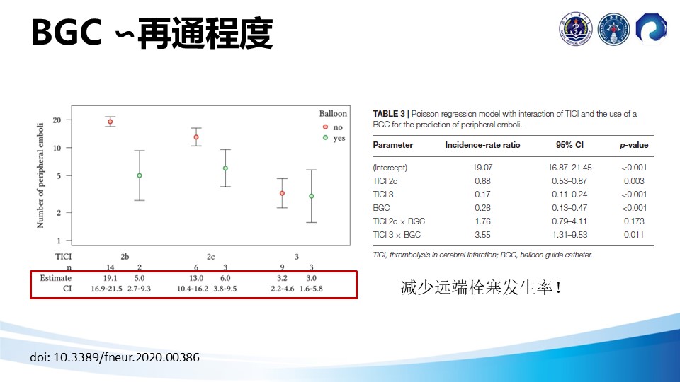 邢鹏飞教授：球囊导管在机械取栓中的临床应用 - 脑医汇