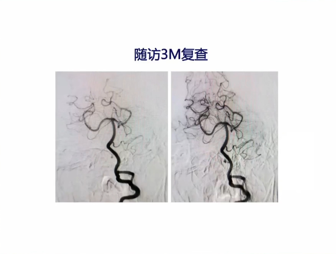 22.png