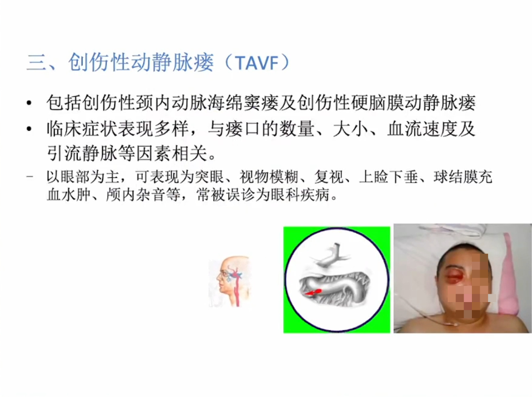 23.png