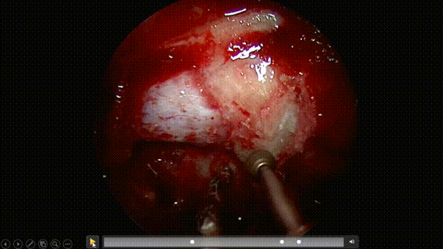 10月18日(1) 00_00_00-00_00_30.gif