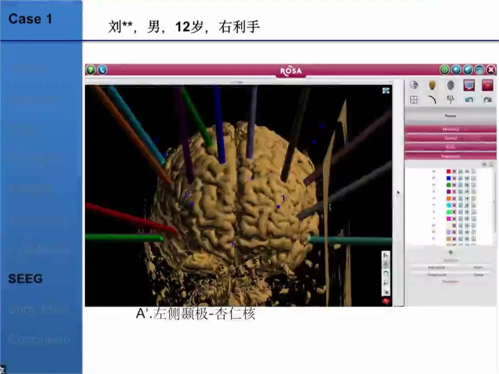35.png