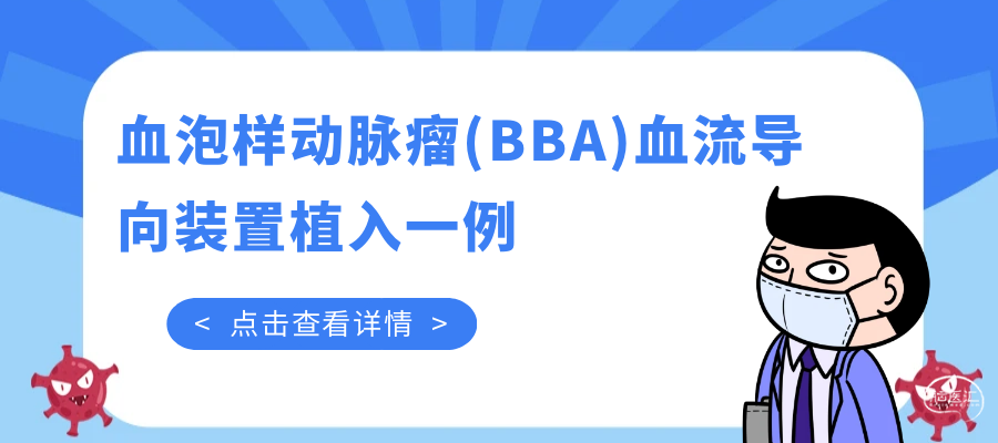 替换.png